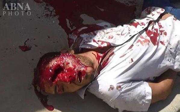 تصاویر/جنایت های داعش در الرمادی