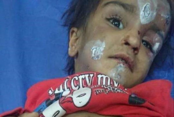 ماجرا و علت شکنجه ستایش 3 ساله در رفسنجان + عکس