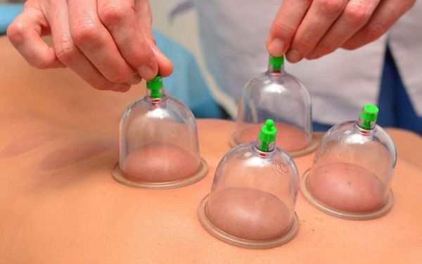 بدترین زمانها برای حجامت