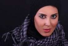 عمل زیبایی بینی بازیگر مشهور زن! +عکس 