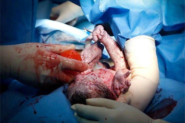 تکذیبیه خبر سهل انگاری پزشک موجب مرگ نوزاد در بیمارستان بندرگز